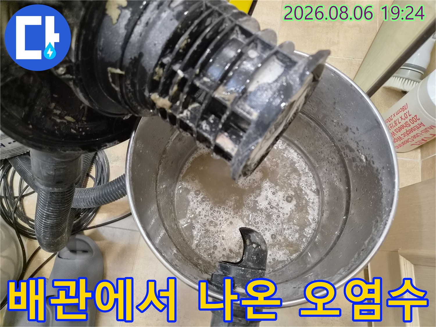 석션 작업 후-스테인리스 통에 모인 탁한 배수물과 찌껍기