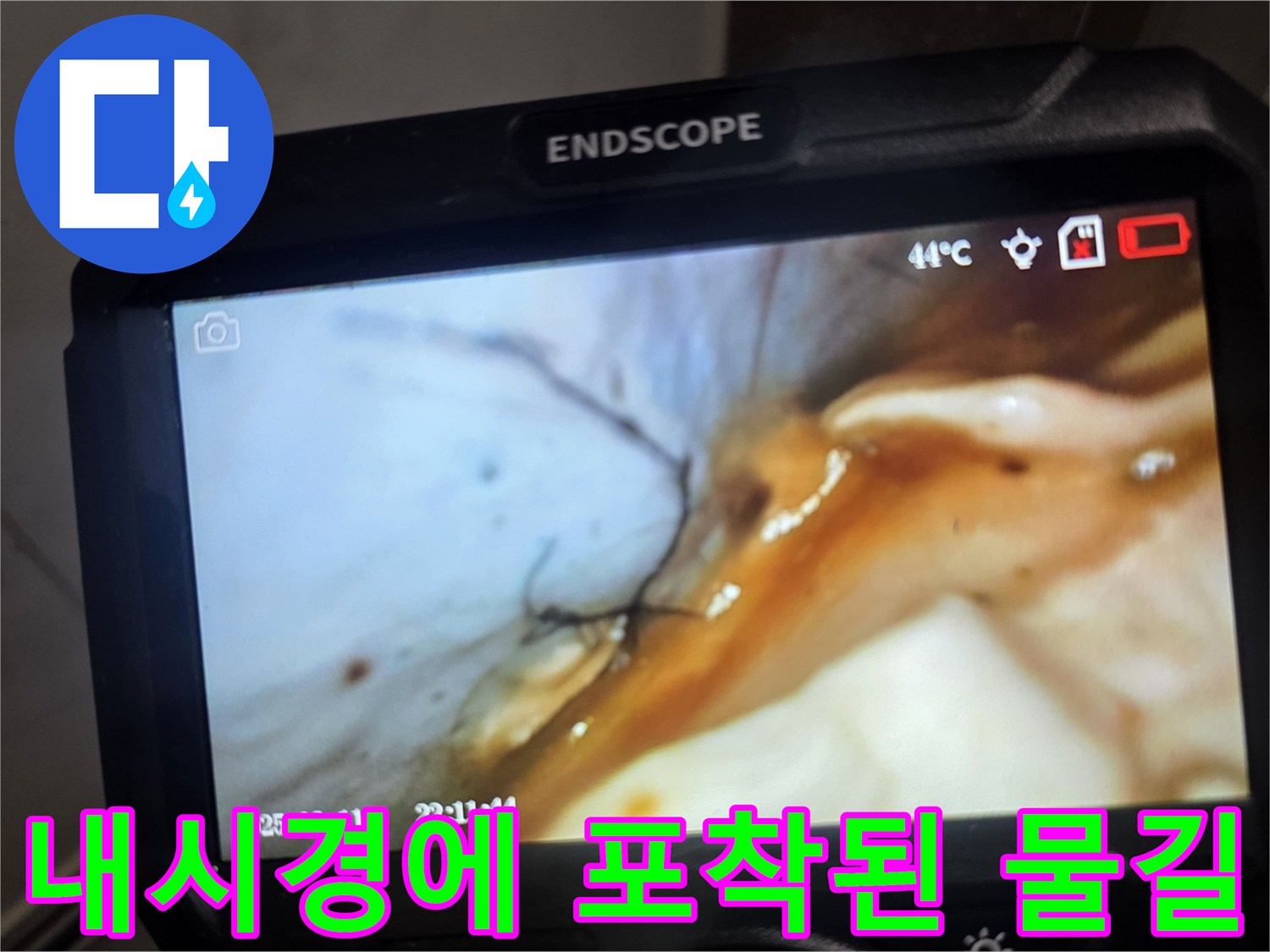 endoscope-showing-leakage-pathway